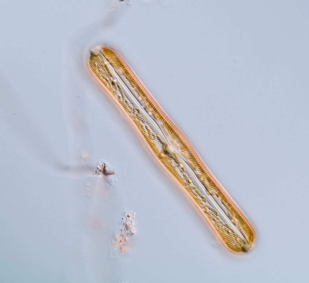 A diatom under the microscope (planaria sp.) 