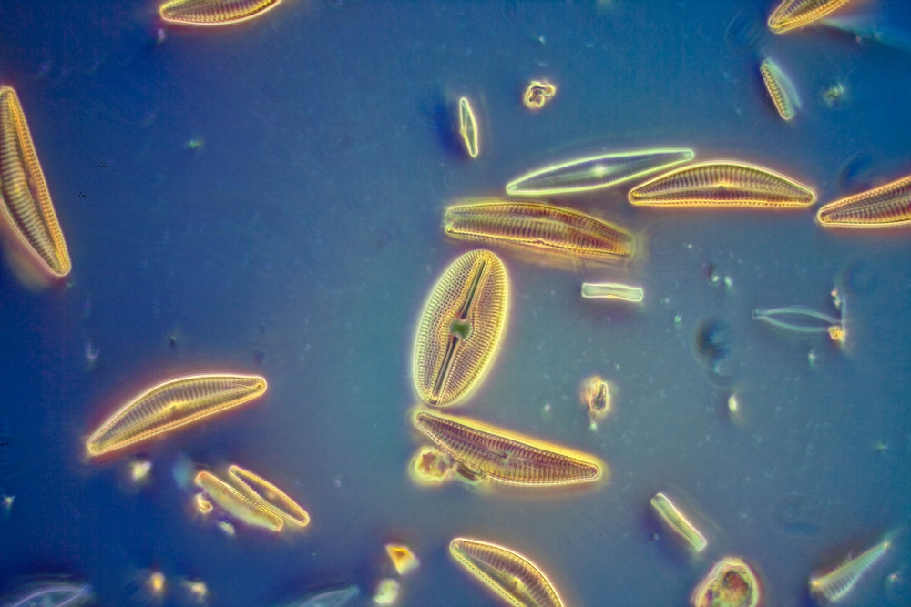 An example of freshwater diatoms under the microscope 